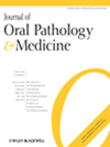 JOURNAL OF ORAL PATHOLOGY & MEDICINE